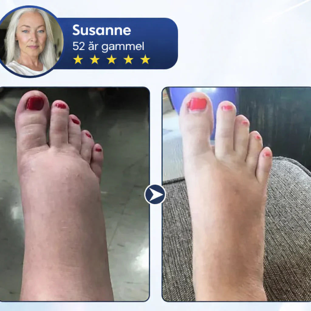 Sveora™ – Lindrande benkräm för lättare ben och bättre blodcirkulation 1+1 Gratis