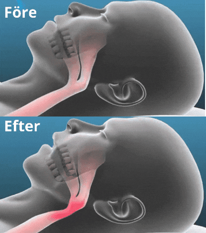 Sveora™ SnoreBalance Bettskena