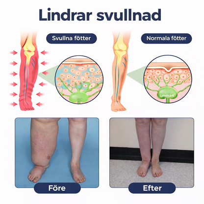 Sveora™ – Lindrande benkräm för lättare ben och bättre blodcirkulation 1+1 Gratis